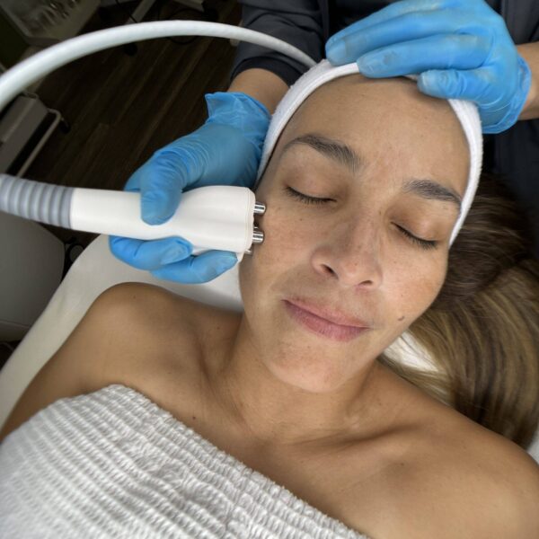 TriBella  TRI MODALITY TOTAL FACIAL THERAPY Photofacial Skin Tightening Skin Resurfacing scaled